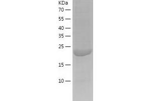 Western Blotting (WB) image for Calcyphosine-Like (CAPSL) (AA 1-208) protein (His tag) (ABIN7288125) (CAPSL Protein (AA 1-208) (His tag))