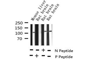 Western Blotting (WB) image for anti-Retinoblastoma 1 (RB1) (pSer780) antibody (ABIN6256422)