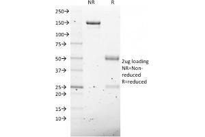 SDS-PAGE Analysis Purified NKX2. (NKX2-8 antibody  (AA 10-123))