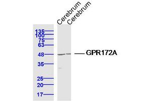 Lane 1: Cerebrum lysates Lane 2: Cerebrum lysates probed with GPR172A Polyclonal Antibody, Unconjugated  at 1:300 dilution and 4˚C overnight incubation. (GPR172A antibody  (AA 101-200))