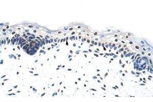 RP11-78J21. (HNRNPA1L2 antibody  (N-Term))