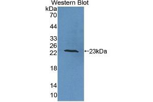 Detection of Recombinant IL6, Human using Polyclonal Antibody to Interleukin 6 (IL6) (IL-6 antibody  (AA 30-212))