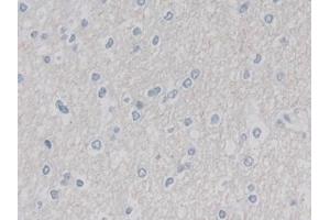 Detection of CUL9 in Human Cerebrum Tissue using Polyclonal Antibody to Cullin 9 (CUL9) (CUL9 antibody  (AA 1144-1322))
