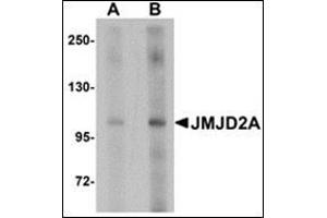 Western blot analysis of JMJD2A in rat liver tissue lysate with this product at (A) 1 and (B) 2 μg/ml.