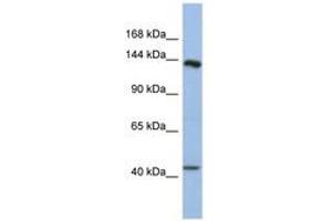 Image no. 1 for anti-Slit Homolog 1 (SLIT1) (AA 1439-1488) antibody (ABIN6744315) (SLIT1 antibody  (AA 1439-1488))