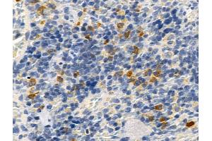 ABIN7093299 and ABIN7097318 at 1/100 staining Rat spleen tissue by IHC-P.