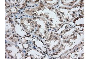 Immunohistochemical staining of paraffin-embedded Human prostate tissue using anti-USP5 mouse monoclonal antibody.