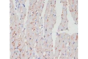Immunohistochemistry of paraffin-embedded Rat heart using CD36 Polyclonal Antibody at dilution of 1:200 (40x lens).