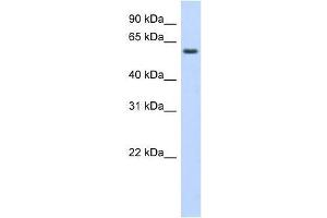 Western Blot showing KLHDC5 antibody used at a concentration of 1-2 ug/ml to detect its target protein. (KLHDC5 antibody  (Middle Region))