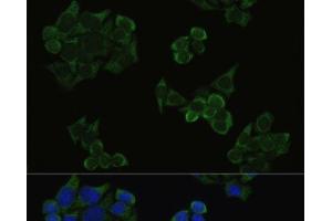 Immunofluorescence analysis of HeLa cells using Phospho-AKT(T308) Polyclonal Antibody at dilution of 1:100. (AKT1 antibody  (pThr308))