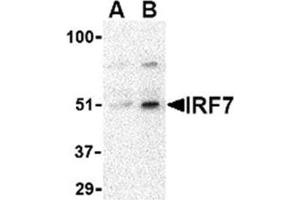 Image no. 1 for anti-Interferon Regulatory Factor 7 (IRF7) (Middle Region) antibody (ABIN318752) (IRF7 antibody  (Middle Region))