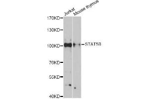 Western blot analysis of extracts of various cell lines, using STAT5B antibody (ABIN5998982) at 1:3000 dilution. (STAT5B antibody)