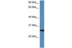 Image no. 1 for anti-RAB27B, Member RAS Oncogene Family (RAB27B) (AA 122-171) antibody (ABIN6747242) (RAB27B antibody  (AA 122-171))