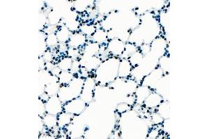Immunohistochemistry of paraffin embedded mouse lung using UBE3A (ABIN7076104) at dilution of 1:1000 (400x lens) (ube3a antibody)