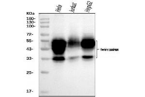 Western blot analysis of CD147/Emmprin using anti-CD147/Emmprin antibody (ABIN7599999). (CD147 antibody  (AA 138-323))