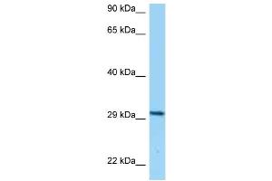WB Suggested Anti-CD80 Antibody Titration: 1. (CD80 antibody  (C-Term))