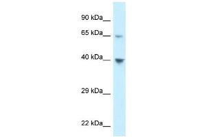 Western Blot showing CCRL1 antibody used at a concentration of 1 ug/ml against 293T Cell Lysate (CCRL1 antibody  (C-Term))