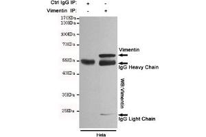 Immunoprecipitation analysis of Hela cell lysates using Vimentin mouse mAb. (Vimentin antibody)