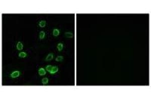 Immunofluorescence analysis of A549 cells, using ATP5G3 antibody. (ATP5G3 antibody)