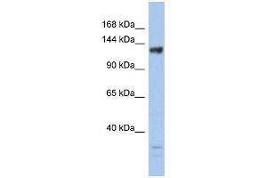 WB Suggested Anti-JMJD2B Antibody Titration: 0. (KDM4B antibody  (Middle Region))