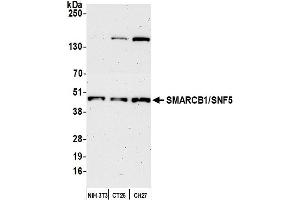 Western Blotting (WB) image for anti-SWI/SNF Related, Matrix Associated, Actin Dependent Regulator of Chromatin, Subfamily B, Member 1 (SMARCB1) (AA 75-125) antibody (ABIN7453587)