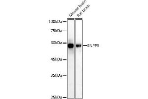 Western blot analysis of extracts of various cell lines, using (ABIN7266899) at 1:1000 dilution. (ENPP5 antibody)