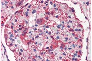 Human Kidney (formalin-fixed, paraffin-embedded) stained with NES antibody ABIN351499 at 5 ug/ml followed by biotinylated anti-mouse IgG secondary antibody ABIN481714, alkaline phosphatase-streptavidin and chromogen. (Nestin antibody  (AA 1464-1614))