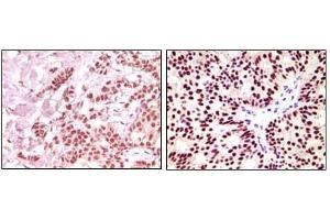 Immunohistochemistry (IHC) image for anti-Estrogen Receptor 1 (ESR1) antibody (ABIN1107144)
