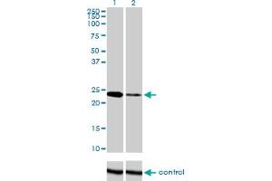 Western blot analysis of TWIST1 over-expressed 293 cell line, cotransfected with TWIST1 Validated Chimera RNAi (Lane 2) or non-transfected control (Lane 1). (TWIST1 antibody  (AA 100-202))