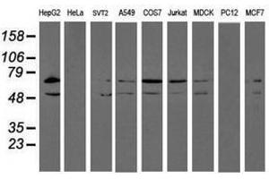 Image no. 2 for anti-Protein Disulfide Isomerase Family A, Member 4 (PDIA4) antibody (ABIN1500106) (PDIA4 antibody)