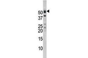 Image no. 2 for anti-Nucleoporin 50kDa (NUP50) (C-Term) antibody (ABIN357219) (NUP50 antibody  (C-Term))
