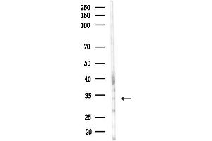 anti-AlkB, Alkylation Repair Homolog 3 (ALKBH3) (Internal Region) antibody