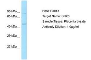 Image no. 1 for anti-Sorting Nexin 6 (SNX6) (AA 208-257) antibody (ABIN6749999) (SNX6 antibody  (AA 208-257))
