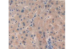 Used in DAB staining on fromalin fixed paraffin- embedded Kidney tissue (BCL10 antibody  (AA 1-233))