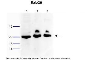 WB Suggested Anti-RAB26 Antibody Titration: 0. (RAB26 antibody  (N-Term))