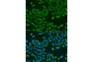 Immunofluorescence analysis of U2OS cells using RPS27A antibody. (RPS27A antibody  (AA 1-156))