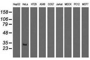 Image no. 1 for anti-Glutathione S-Transferase theta 2 (GSTT2) antibody (ABIN1498559) (GSTT2 antibody)