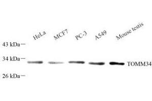Western blot analysis of TOMM34 (ABIN7075984) at dilution of 1: 1000 (TOMM34 antibody)