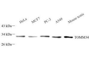 Western blot analysis of TOMM34 (ABIN7075984) at dilution of 1: 1000