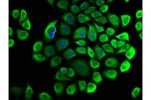 Immunofluorescence staining of Hela cells with ABIN7147101 at 1:33, counter-stained with DAPI. (CNOT3 antibody  (AA 257-395))