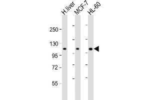 All lanes : Anti-RSBN1 Antibody (N-term) at 1:2000 dilution Lane 1: human liver lysate Lane 2: MCF-7 whole cell lysate Lane 3: HL-60 whole cell lysate Lysates/proteins at 20 μg per lane.