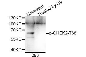 Western blot analysis of extracts of 293 cells, using Phospho-CHEK2-T68 antibody. (CHEK2 antibody  (pThr68))