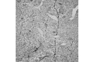 IHC on rat brain (paraffin sections) using Rabbit antibody to RhoA   at a concentration of 15 µg/ml, incubated overnight and developed with DAB Ni. (RHOA antibody  (AA 100-150))