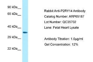 Western Blotting (WB) image for anti-Purinergic Receptor P2Y, G-Protein Coupled, 14 (P2RY14) (C-Term) antibody (ABIN2790071) (P2RY14 antibody  (C-Term))