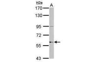 Image no. 1 for anti-Zinc Finger Protein 596 (ZNF596) (AA 1-175) antibody (ABIN1501850) (ZNF596 antibody  (AA 1-175))
