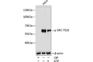 Western blot analysis of extracts of various cell lines using Phospho-SRC(Y529) Polyclonal Antibody at dilution of 1:1000. (Src antibody  (pTyr529))
