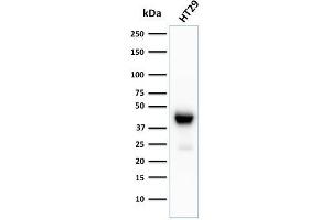 Western Blot Analysis of HT29 cell lysate using CK20 Recombinant Rabbit Monoclonal Antibody (KRT20/3129R).