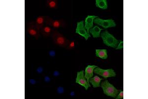 ABIN6254871 and ABIN6274016 staining Hela cells(heat shock treatment) by IF/ICC. (Histone H2A antibody  (acLys9))