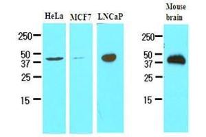 Cell lysates of HeLa, MCF7, LnitrocelluloseaP and mouse brain (30 ug) were resolved by SDS-PAGE, transferred to nitrocellulose membrane and probed with anti-human TREM2 (1:500). (TREM2 antibody  (AA 19-161))