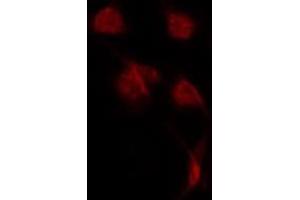 ABIN6275656 staining LOVO by IF/ICC. (USP42 antibody  (Internal Region))